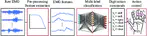 Myoelectric Prosthesis Control